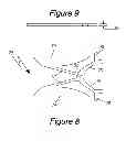 Fig. 09 - Spinal plate assembly
