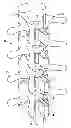 Fig. 01 - ORTHOSIS TO CORRECT SPINAL DEFORMITIES