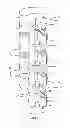 Fig. 02 - ORTHOSIS TO CORRECT SPINAL DEFORMITIES