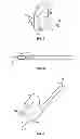 Fig. 03 - ORTHOSIS TO CORRECT SPINAL DEFORMITIES