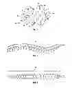 Fig. 04 - ORTHOSIS TO CORRECT SPINAL DEFORMITIES