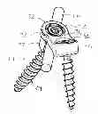 Fig. 01 - CONNECTORS FOR A SECONDARY BONE ANCHOR