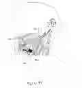 Fig. 12 - Antenna providing variable communication with an implant