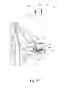 Fig. 12 - Apparatus and method to control an implant
