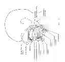Fig. 03 - Devices and methods for sleep apnea treatment