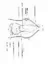 Fig. 05 - Devices and methods for sleep apnea treatment