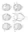 Fig. 07 - Devices and methods for sleep apnea treatment