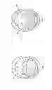 Fig. 13 - Devices and methods for sleep apnea treatment
