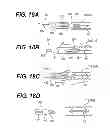 Fig. 15 - Devices and methods for sleep apnea treatment