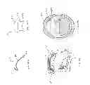 Fig. 17 - Devices and methods for sleep apnea treatment