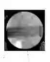 Fig. 03 - METHOD OF TREATING CHRONIC PAIN IN A PATIENT USING NEUROMODULATION