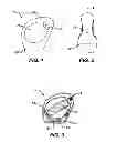 Fig. 02 - THERMAL BODY-CARE ELEMENT AND METHOD OF USE OF SAME