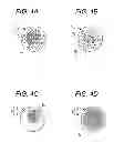 Fig. 04 - STIMULUS ELECTRODE FOR BIOLOGICAL TISSUE AND METHOD OF PRODUCING THE SAME
