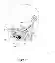 Fig. 12 - Modulator apparatus configured for implantation