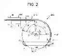 Fig. 03 - Apparatus for and method of pulling a tensile member from a medical device