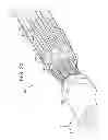 Fig. 22 - Apparatus for and method of pulling a tensile member from a medical device