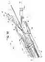 Fig. 28 - Apparatus for and method of pulling a tensile member from a medical device