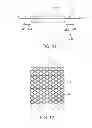 Fig. 10 - MODIFIED SCAFFOLDS FOR PERIPHERAL APPLICATIONS