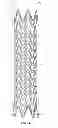 Fig. 04 - Electrospun PTFE coated stent and method of use