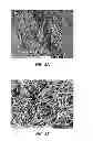 Fig. 08 - Electrospun PTFE coated stent and method of use