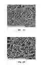 Fig. 10 - Electrospun PTFE coated stent and method of use