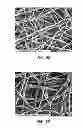 Fig. 11 - Electrospun PTFE coated stent and method of use