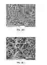 Fig. 12 - Electrospun PTFE coated stent and method of use