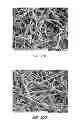 Fig. 13 - Electrospun PTFE coated stent and method of use