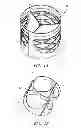 Fig. 02 - Prosthetic Heart Valves, Support Structures and Systems and Methods for Implanting the Same