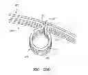 Fig. 48 - Prosthetic Heart Valves, Support Structures and Systems and Methods for Implanting the Same