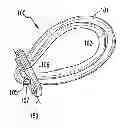 Fig. 01 - Double-loop endobutton, ovoid tunnel guide, and method of ACL re-construction using the ovoid tunnel guide and the double-loop endobutton
