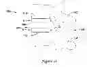 Fig. 22 - Interbody vertebral spacer