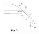 Fig. 04 - Self centering, anti-seizing acetabular liner