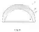 Fig. 05 - Self centering, anti-seizing acetabular liner