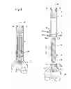 Fig. 02 - Prosthesis for Partial Replacement of a Tubular Bone