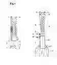 Fig. 05 - Prosthesis for Partial Replacement of a Tubular Bone