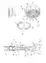 Fig. 07 - Prosthesis for Partial Replacement of a Tubular Bone