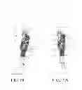 Fig. 20 - Four-link hydraulic buffer knee joint assembly