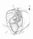 Fig. 02 - HELMET IMPACT LINER SYSTEM