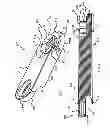 Fig. 02 - Modular bone plate system