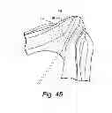 Fig. 28 - Cushion for patient interface
