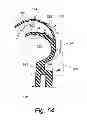 Fig. 37 - Cushion for patient interface