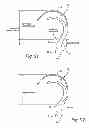 Fig. 52 - Cushion for patient interface