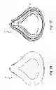 Fig. 09 - Cushion for patient interface
