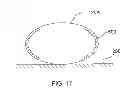 Fig. 11 - Alternating patterns in cigarette wrapper, smoking article and method