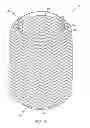 Fig. 09 - Method for manufacturing exhaust connection member with preformed braided cover