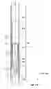 Fig. 06 - Re-latch mechanism for wellbore liner system