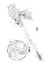 Fig. 02 - Grasping jaw mechanism