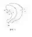 Fig. 02 - Passenger airbag device