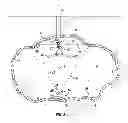Fig. 04 - Laser scanning apparatus and method of use